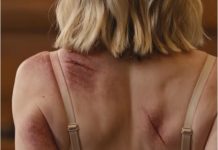 At my divorce hearing, my husband leaned back and smirked. “Couldn’t afford a lawyer?” The courtroom waited for me to break. Instead, I stood. “No, Your Honor. I came with evidence.” Then I stood, slipped off my coat, and revealed the scars he believed would stay buried forever. For the first time, his confidence di/ed before the verdict did….