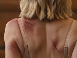 At my divorce hearing, my husband leaned back and smirked. “Couldn’t afford a lawyer?” The courtroom waited for me to break. Instead, I stood. “No, Your Honor. I came with evidence.” Then I stood, slipped off my coat, and revealed the scars he believed would stay buried forever. For the first time, his confidence di/ed before the verdict did….