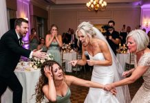 My sister hit me in the head with a metal mic at her wedding: “Calm down, it slipped.” My fingers came back bloody. At the ER, the doctor stopped cold: “Do you know what this is?”